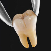 دندان کشیدن عجیب توسط دندان پزشک هندی + ویدئو