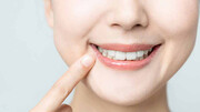 سفید کردن دندان با وایتکس واقعیت دارد؟