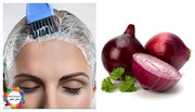 درمان طبیعی و سریع ریزش مو با پیاز