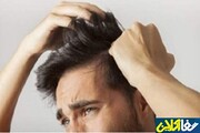 روش پیشگیری و کاهش ریزش مو در آقایان