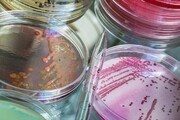 کشف یک آنتی بیوتیک طبیعی برای عفونی ترین بیماری‌ها