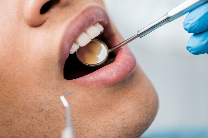 عوامل اصلی نابودی دندان