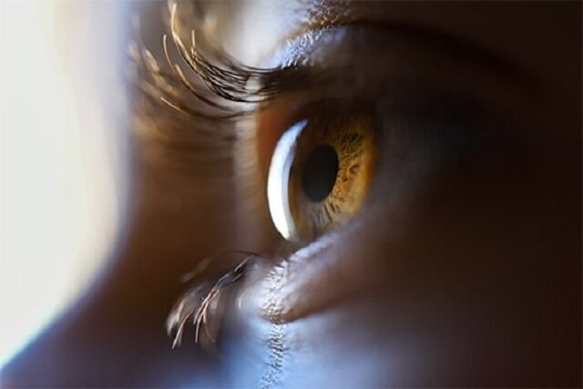 درمان چشم متورم به روش ساده و خانگی