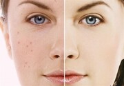 داشتن پوست شفاف و شاداب با چند روش طبیعی