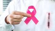 ۶ مورد از نشانه‌های سرطان سینه