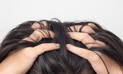 دلایل درد پوست سر هنگام شانه کردن