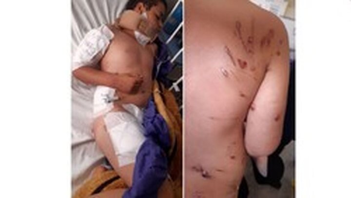 حمله وحشتناک سگ های ولگرد به پسر بچه ای در جنوب تهران + عکس