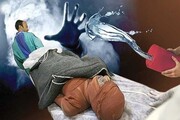اسیدپاشی مرگبار دختر تهرانی روی پدرش