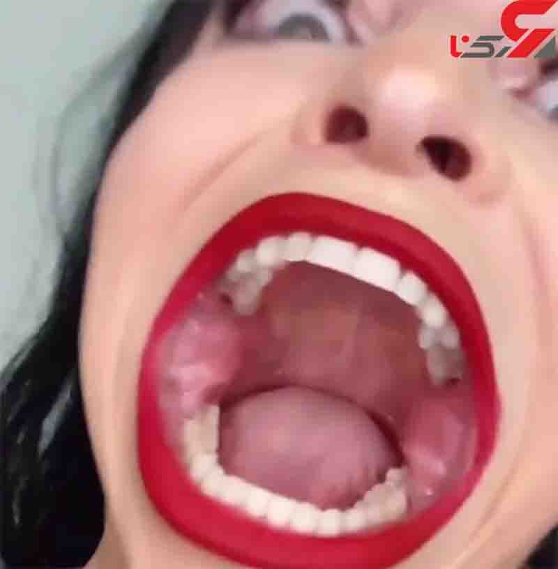 بزرگترین دهان دنیا (3)