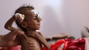 سازمان ملل نسبت به بحران قحطی در یمن هشداد داد