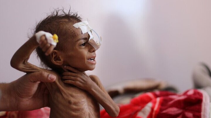سازمان ملل نسبت به بحران قحطی در یمن هشداد داد