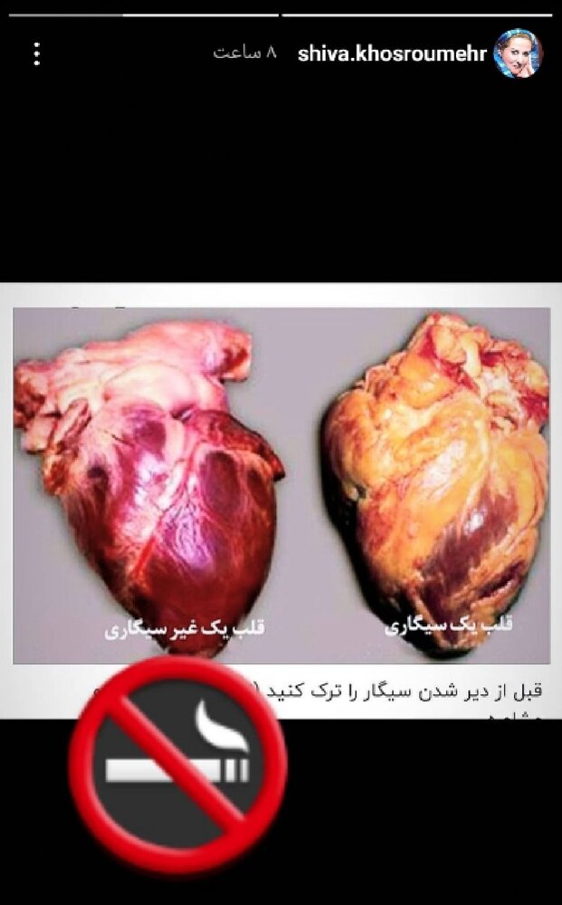 تاثیر سیگار بر قلب