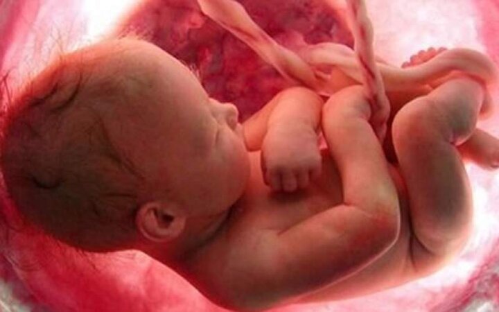  نگهداری حیوانات خانگی موجب سقط جنین می‌شود