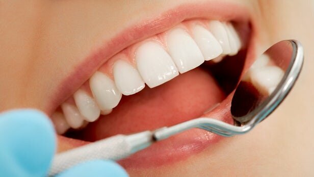  سفیدکردن دندان‌ها به روش طبیعی