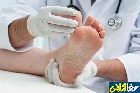 درمان میخچه و چند بیماری مربوط به پا با روشی ساده و خانگی