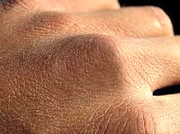 چند روش خانگی برای رفع خشکی پوست دست