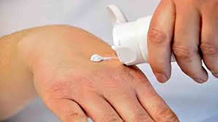درمان خشکی دست در زمستان 
