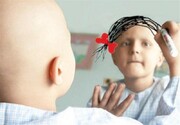 هشدار نسبت به سرعت رشد سرطان در ایران؛ سالانه ۵۱ هزار مرگ سرطان داریم