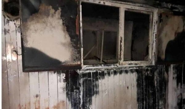 سوختگی ۸۰ درصدی یک معلم در حادثه‌ آتش‌سوزی کانکس خوزستان