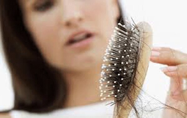 ریزش مو هم به لیست عوارض ابتلا به ویروس کرونا اضافه شد