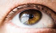 شناسایی علائم بیماری ها از روی چشم؛ از سرطان تا ایدز