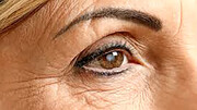 علائم بیماری گلوکوم یا آب سیاه چشم | چه عواملی باعث ابتلا به گلوکوم می شود؟