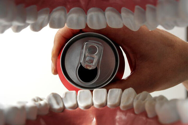 اثرات باورنکردنی نوشابه در تخریب دندان/ فیلم