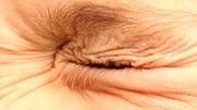 دلیل تورم پلک چیست؟ | درمان انقباض چشم با چند روش ساده خانگی