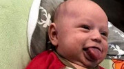 نوزادی که هر روز زبانش درازتر می‌شود/ عکس
