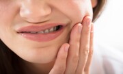 علت خارش دندان چیست؟ + نحوه درمان