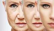 علت اصلی پیری زود هنگام پوست چیست؟ + پیشگیری و نحوه درمان