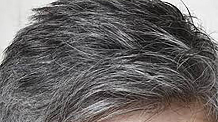 آیا موهای سفید را می‌توان دوباره سیاه کرد؟ | دلیل ایجاد موهای سفید بر روی سر چیست؟ + پیشگیری و درمان