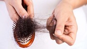 پیشگیری و درمان ریزش مو با مصرف ویتامینD | برای جذب ویتامینD چه بخوریم؟