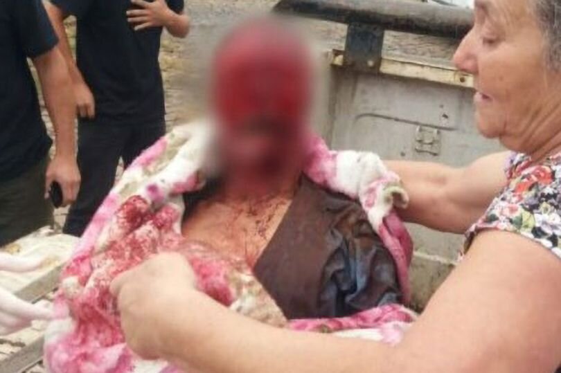 مرگ دلخراش مرد برزیلی پس از حمله وحشیانه چند سگ + تصاویر