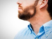 آشنایی با بیماری‌های رایج درباره ریش مردان