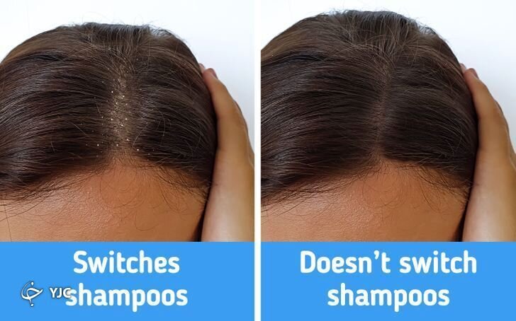 ۱۰ اشتباهات رایجی که به موی شما آسیب می‌رساند+ تصاویر