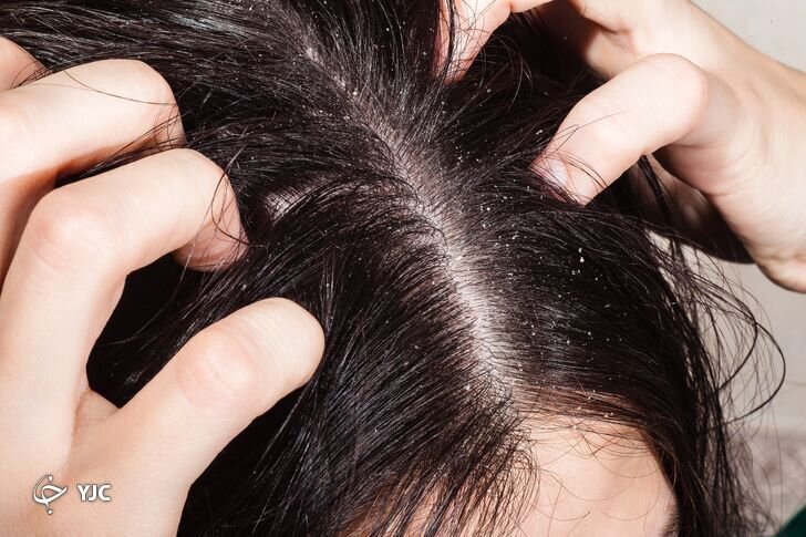 ۱۰ اشتباهات رایجی که به موی شما آسیب می‌رساند+ تصاویر
