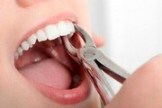 دلایل اصلی درد دندان چیست؟