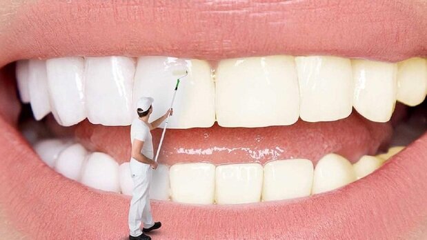 علت زردی دندان چیست؟ | سفیدکردن دندان‌ها با چند روش ساده و طبیعی 