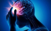 افزایش خطر سکته مغزی با یک ضربه مغزی خفیف