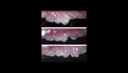 تحقیقات امیدوارکننده ژاپنی‌ها درباره احتمال رشد دندان‌های جدید در بزرگسالی