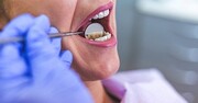 ترکیبات تشکیل دهنده خمیر دندان چیست؟