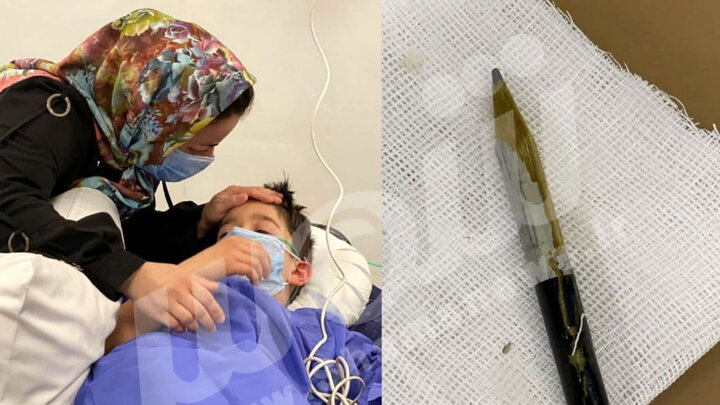  پسر ۸ ساله تبریزی یک مداد را قورت داد! / عکس