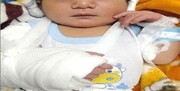 ماجرای جنجالی تولد نوزاد خرمشهری با دست شکسته چه بود؟