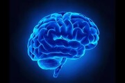 آشنایی با چند راه اصلی برای پیشگیری از سکته مغزی