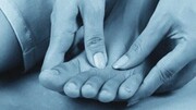 سندرم انگشت پای آبی چیست و چگونه ایجاد می‌شود؟