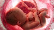 تغییر جنسیت جنین در بدن مادر! / فیلم