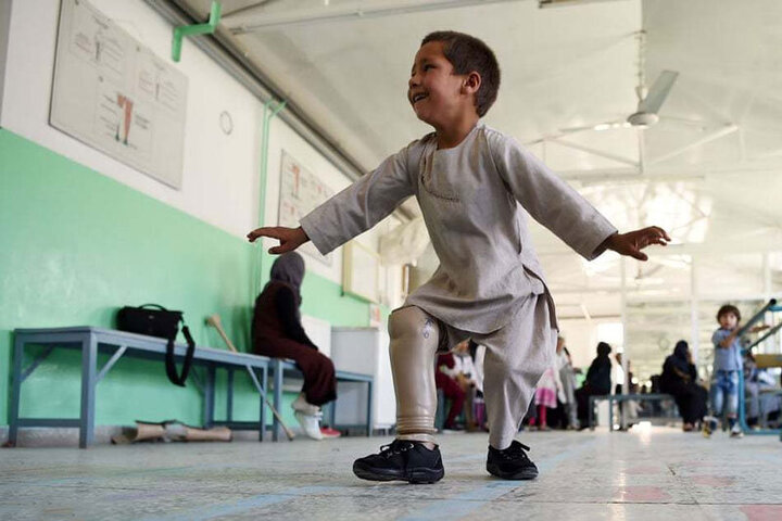 رقص جالب کودک افغانستانی پس از دریافت پای مصنوعی / فیلم