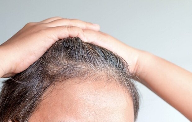 پیشگیری از سفید شدن موها با مصرف این خوراکی‌ها | مهمترین دلیل سفید شدن مو چیست؟