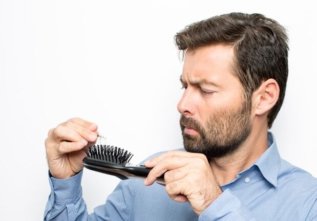 دلیل ریزش مو در مردان چیست؟ + نحوه درمان 